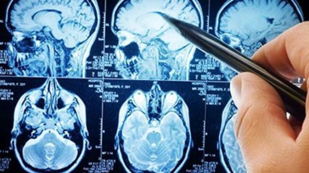 بیماری های مغز و اعصاب پزشک در حال تشریح بیماری های مغز و اعصاب