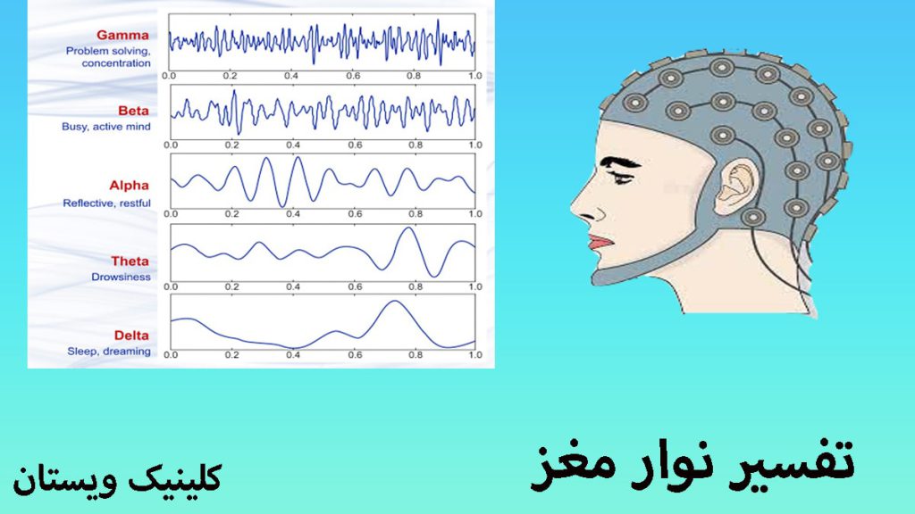 تفسیر نوار مغز دو تصویر از نوار مغز و امواج آن