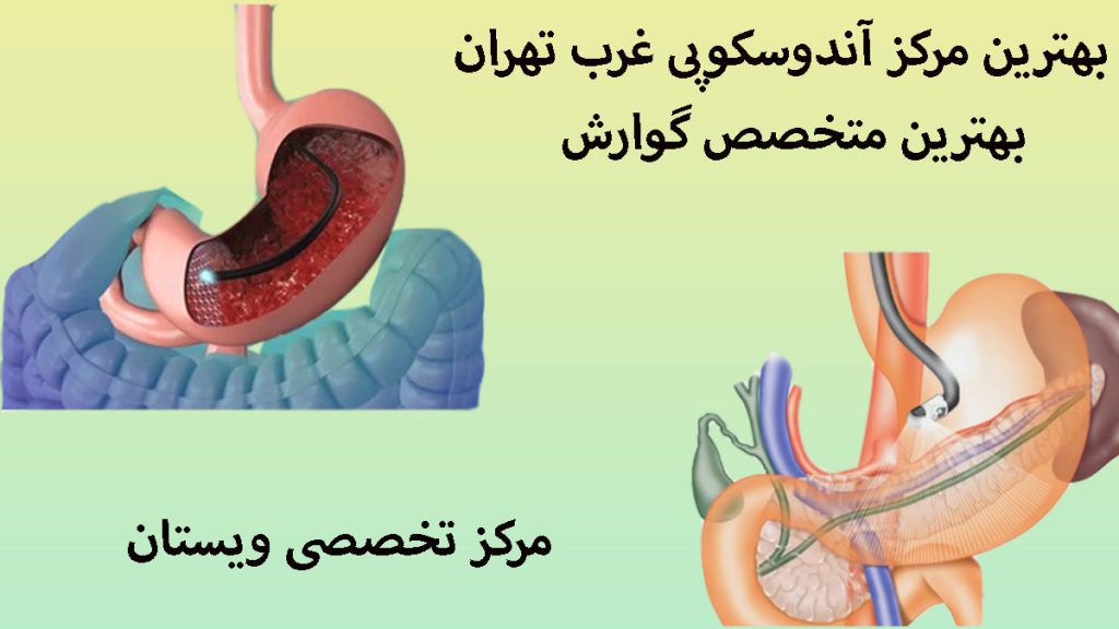 دو تصویر از آندوسکوپی معده