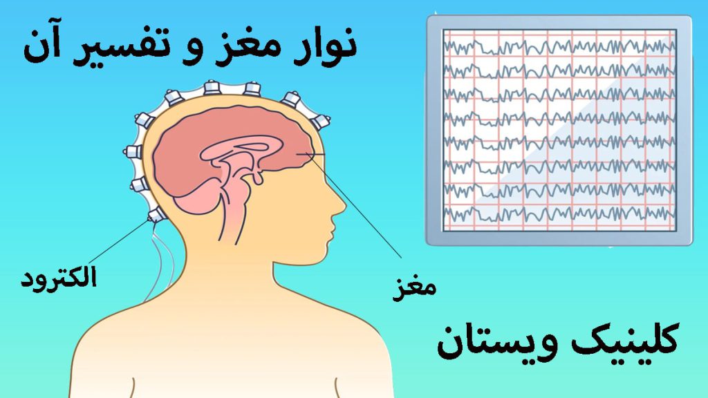 یک مولاژبدن انسان برای توضیح نوار مغز