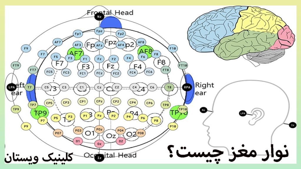 نوار مغز نمایش مراحل مختلف نوار مغز