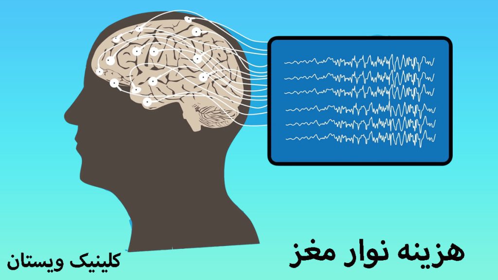 هزینه نوار مغز تصویری انیمشنی از نوار مغز +نوشته با عنوان هزینه نوار مغز