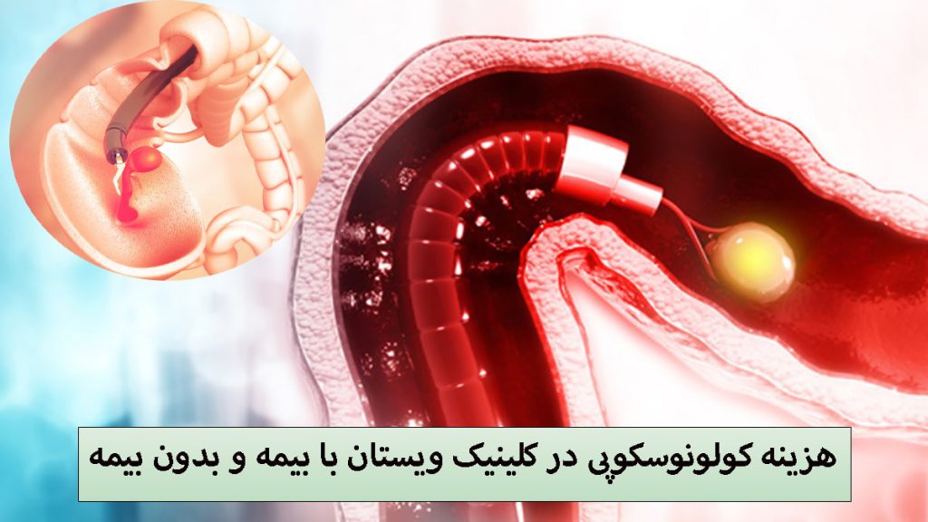 هزینه کولونوسکوپی تصویری دیجیتالی از کولونوسکوپی +نوشته با عنوان هزینه کولونوسکوپی