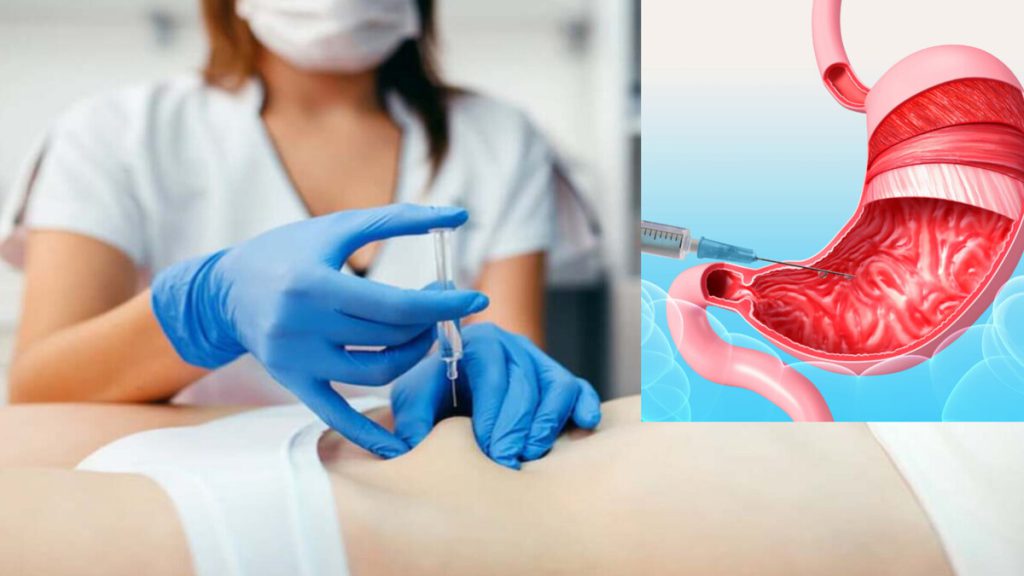 انجام بوتاکس معده برای بیمار توسط متخصص پزشک متخصص برای بیمار بوتاکس معده انجام می دهد