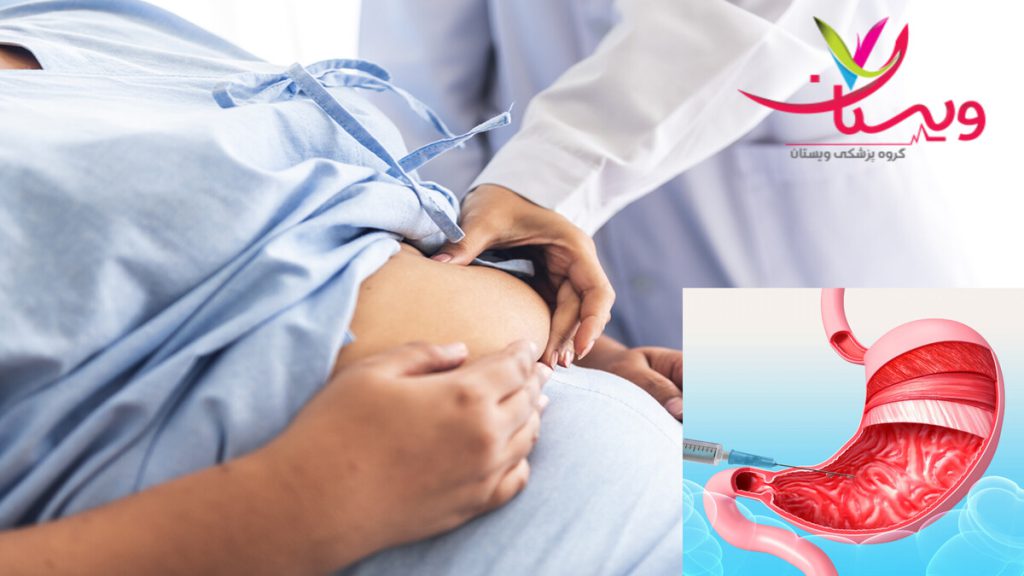 معاینه بیمار برای انجام بوتاکس معده پزشک در حال معاینه شکم بیمار برای بوتاکس معده