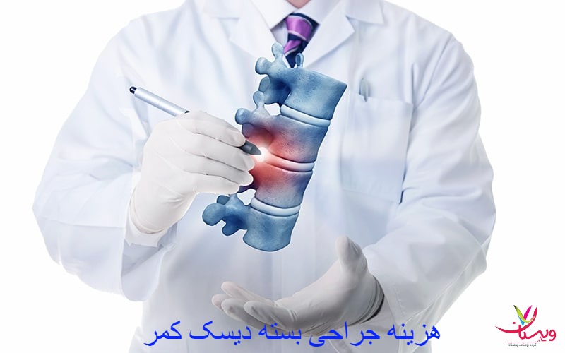 ماکت ستون فقرات کمر در دست پزشک