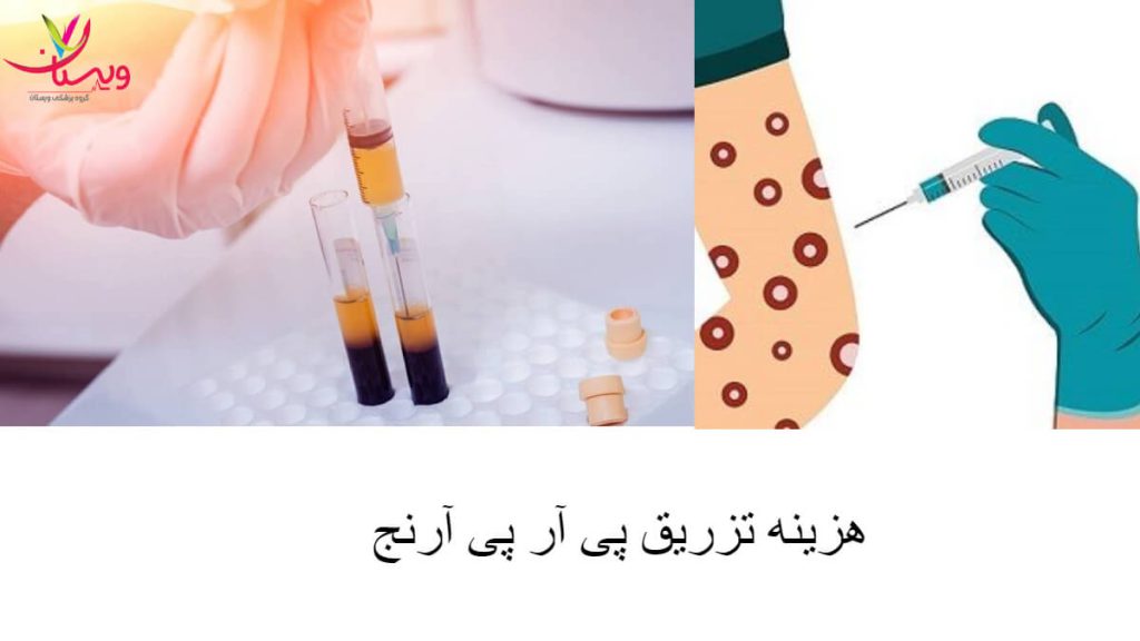 هزینه تزریق پی آر پی به آرنج هزینه تزریق پی آر پی به آرنج