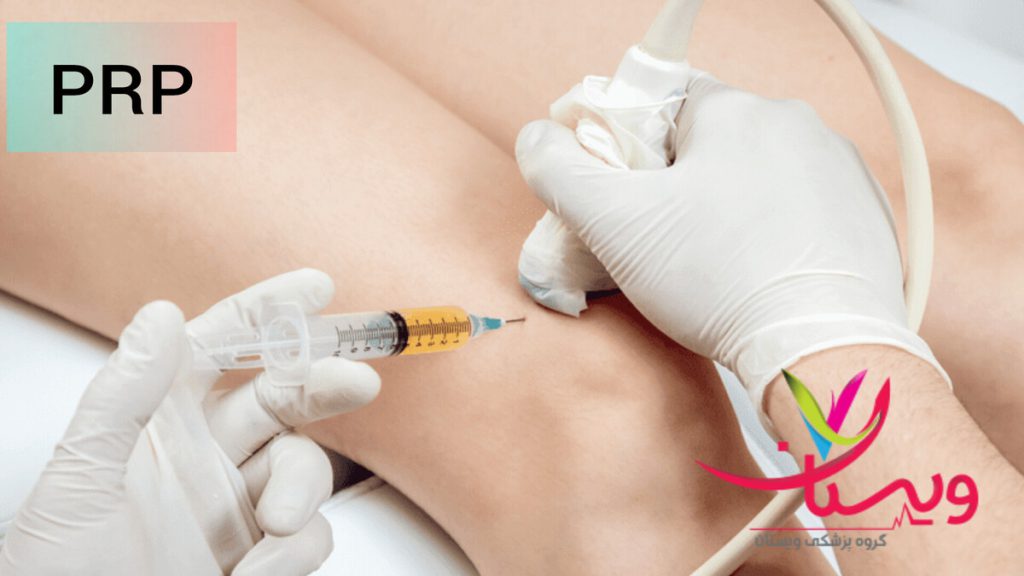 انجام پی آر پی توسط پزشک انجام پی آر پی در بهترین کلینیک پی آر پی در غرب تهران توسط پزشک