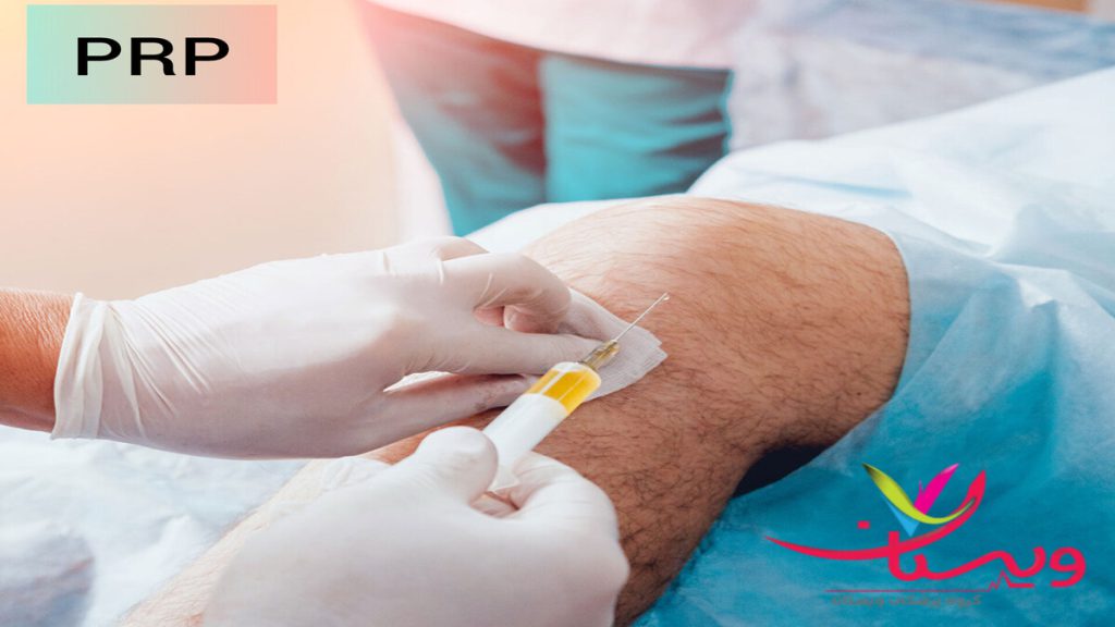 پزشک در حال انجام پی آر پی زانو برای بیمار