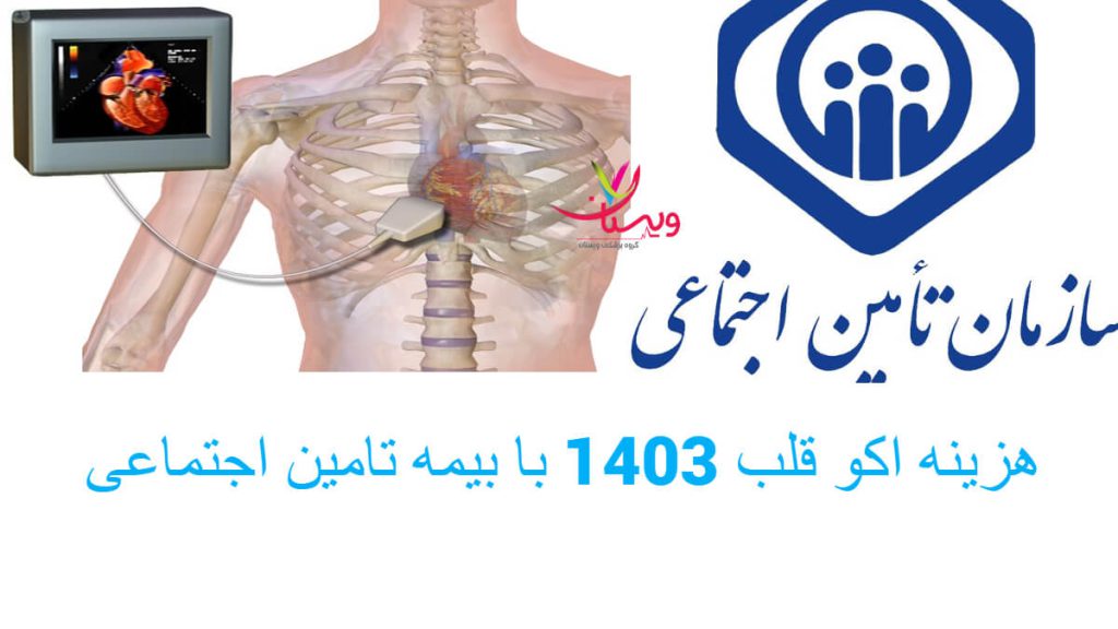 هزینه اکو قلب و بیمه تامین اجتماعی