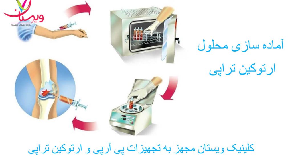 آماده سازی محلول ارتوکین تراپی آماده سازی محلول ارتوکین تراپی
