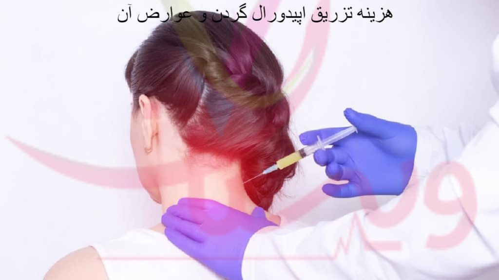 تزریق اپیدورال به گردن