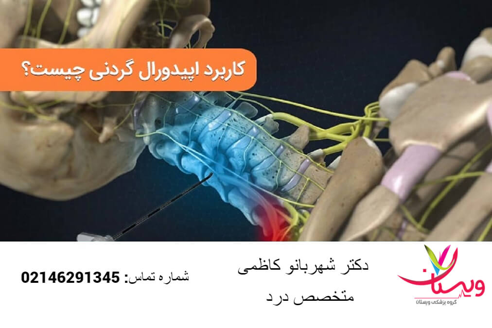 کاربردی اپیدورال گردنی کاربردی اپیدورال گردنی