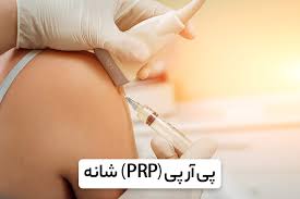 پی آر پی شانه