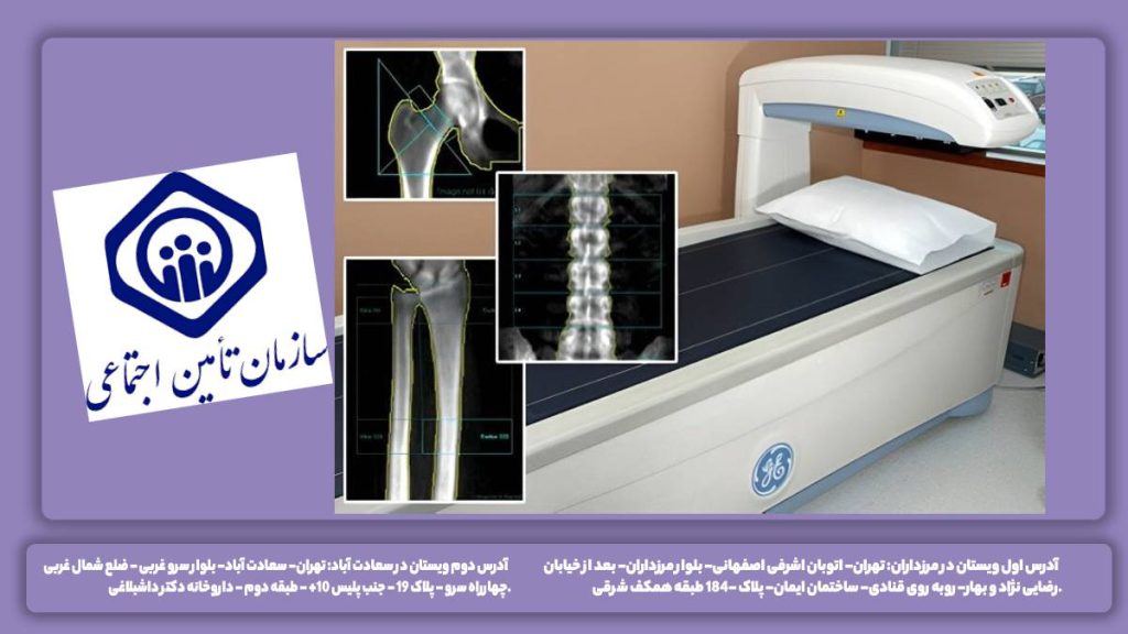 تراکم استخوان تامین اجتماعی کلینیکهای تخصصی تحت قرارداد رسمی بیمه تامین اجتماعی