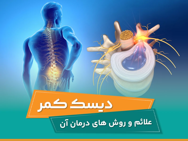 علاِیم دیسک کمر