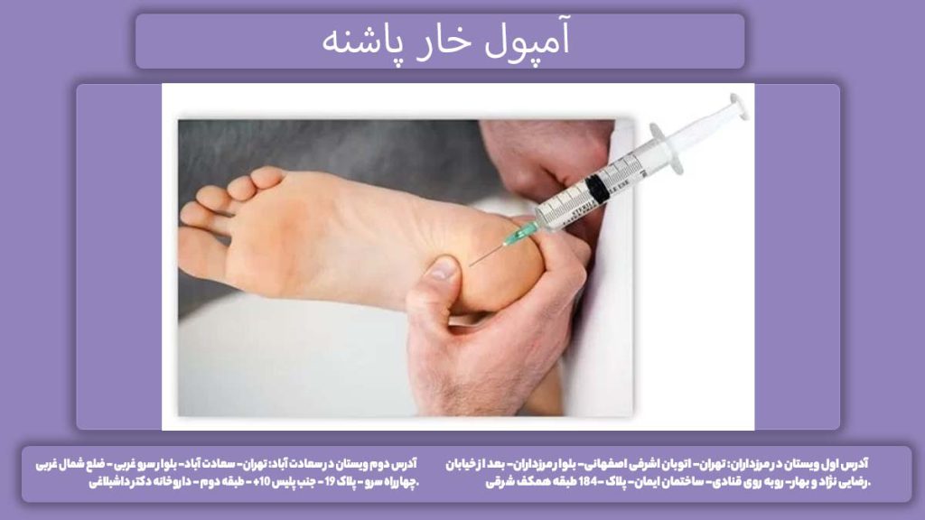 نرخ آمپول برای درمان خار پاشنه بررسی قیمت آمپول خار پاشنه