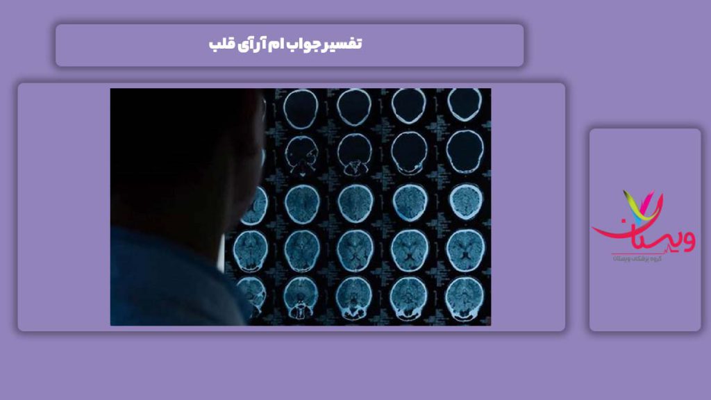 جواب ام آر آی قلب تفسیر جواب ام آر آی قلب