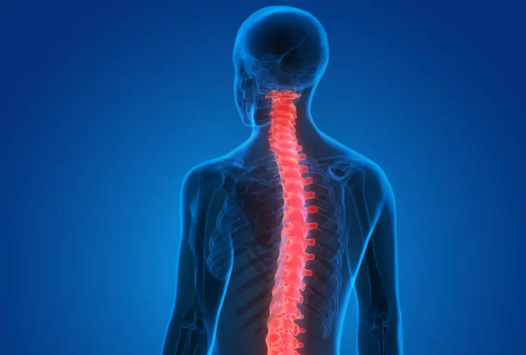 ستون فقرات و مهره ها با سی تی اسکن بهتر دیده می شوند. کمر درد مزمن