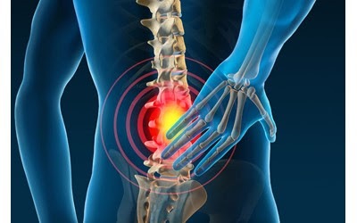 درد دیسک کمر معمولا از یک سمت شروع می شود. کمر درد مزمن