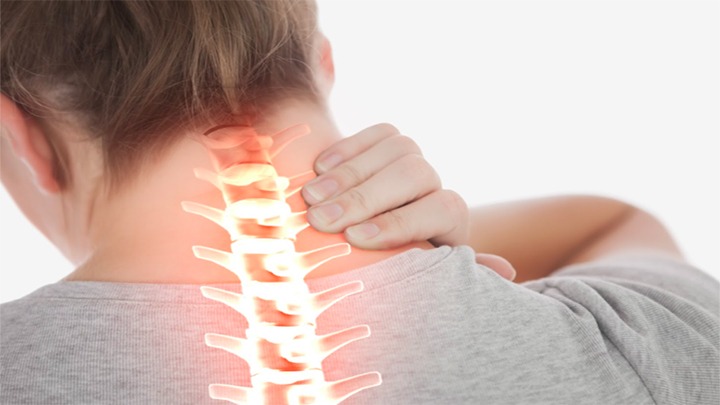 فتق دیسک گردن