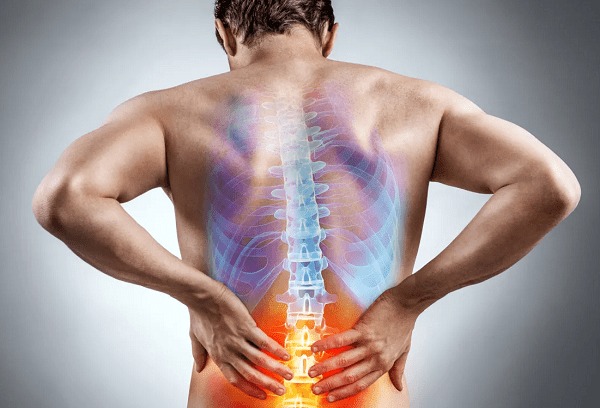 درد دیسک کمر و سیاتیک بسیار شدید است دیسک کمر و سیاتیک