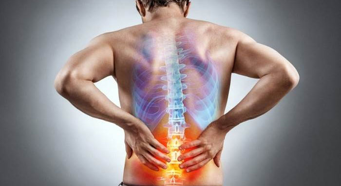 سندروم فاست لومبار