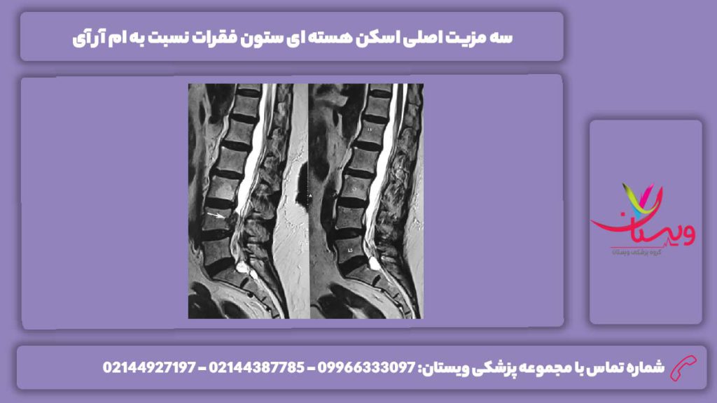 ویژگی اسکن نسبت به ام آر آی اسکن هسته ای ستون فقرات