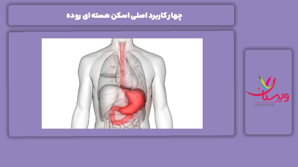 کاربرد اصلی این نوع اسکن 4 کاربرد اصلی اسکن هسته ای روده