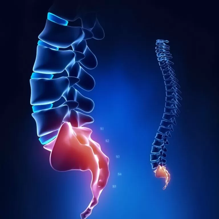 درد دنبالچه با درد دیسک کمر متفاوت است. درد دنبالچه