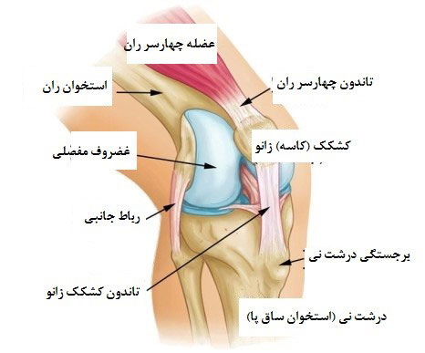 سندروم درد پاتلوفمورال باعث گرفتگی عضله زانو می شود. سندروم درد پاتلوفمورال یک نوع بیماریی است که در جلوی زانو قرار دارد.