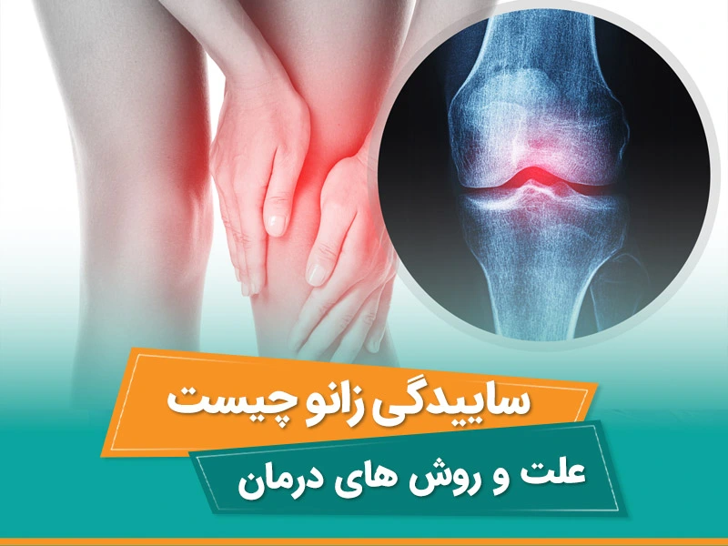 هنگام ساییدگی زانو استخوان ها نسبت به هم نزدیک شده و سایش می شوند. التهاب در آرتروز زانو باعث سفتی مفصل می شود.