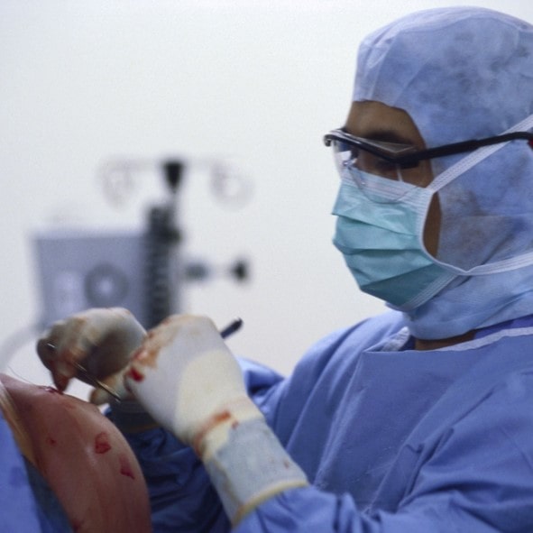 درمان جراحی بیماری شانه یخزده آخرین گزینه است. التهاب سبب ضخیم شدن بافت داخلی مفصل شانه یخزده می شود.