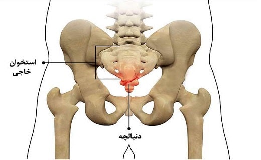 دنبالچه همان قسمت پایینی کمر که به شکل دم است. درد دنبالچه
