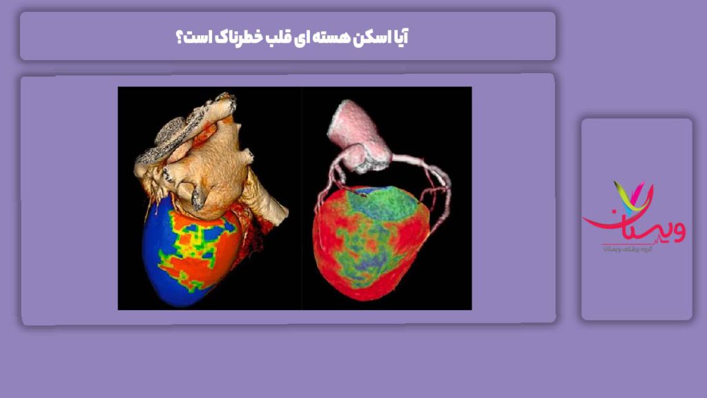میزان خطرناک بودن اسکن هسته ای قلب آیا اسکن هسته ای قلب خطرناک است؟