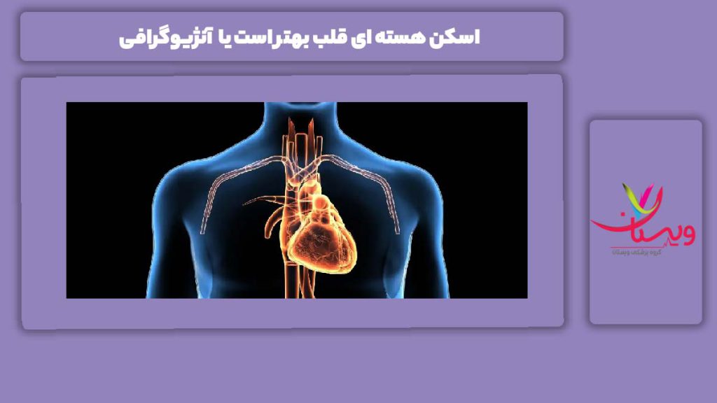 فرق بین اسکن هسته ای قلب و آنژیوگرافی اسکن هسته ای قلب بهتر است یا آنژیوگرافی