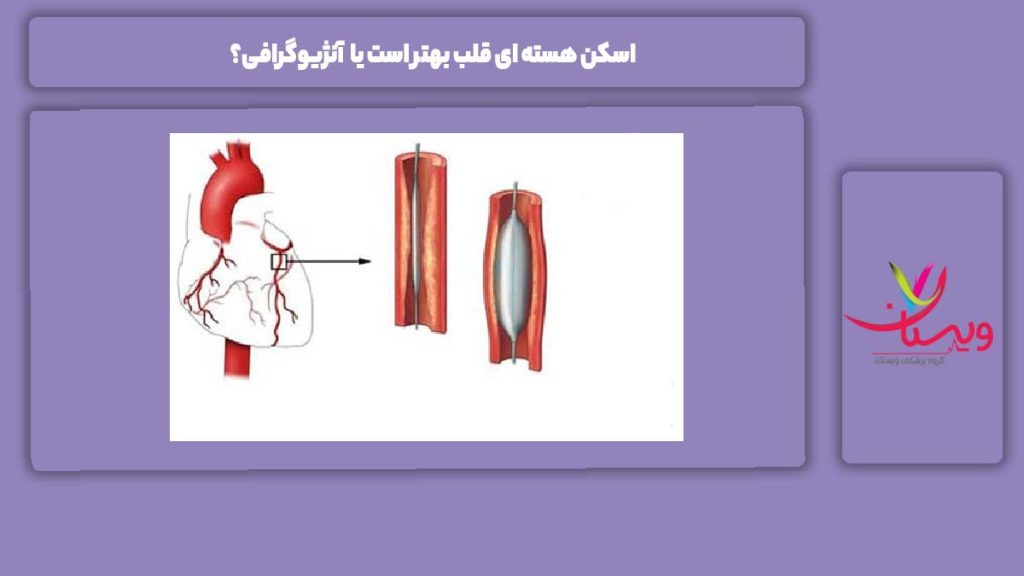 فرق بین اسکن هسته ای قلب با آنژیو اسکن هسته ای قلب بهتر است یا آنژیوگرافی؟