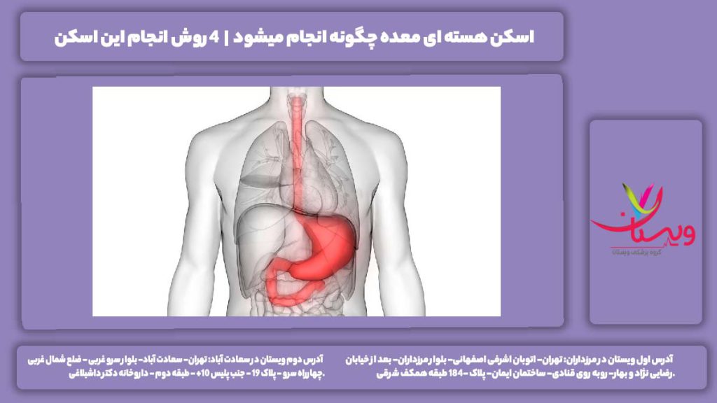 اسکن هسته ای معده