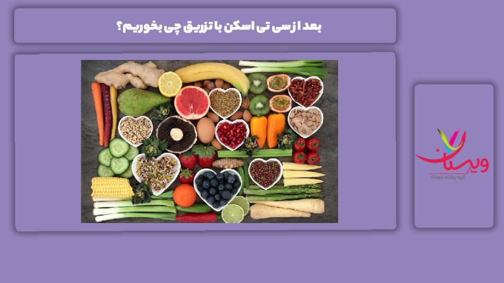 پرهیزات غذایی بعد از سی تی اسکن با تزریق چی بخوریم؟