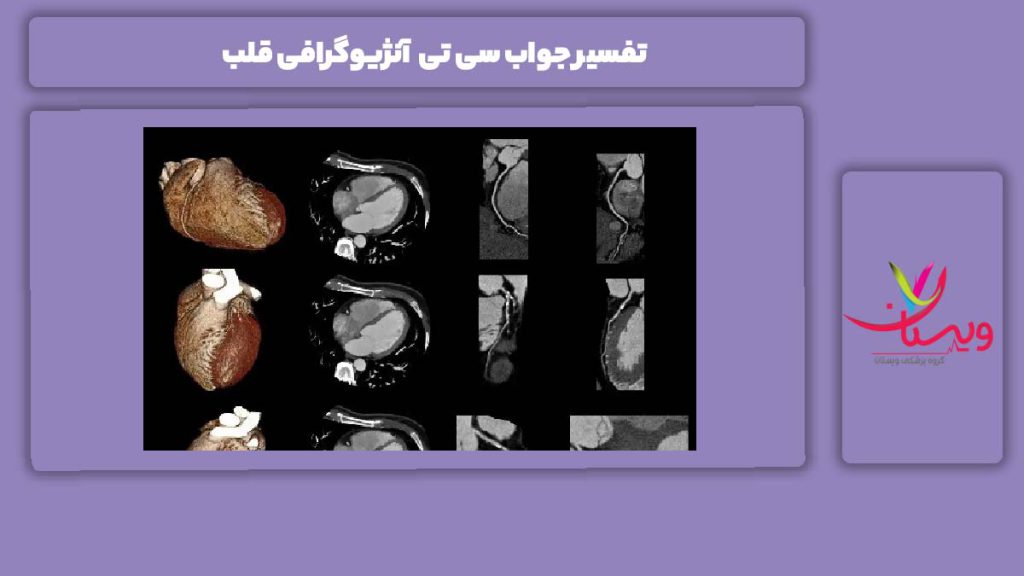 توضیح و شرح جواب سی تی آنژیو تفسیر جواب سی تی آنژیوگرافی قلب