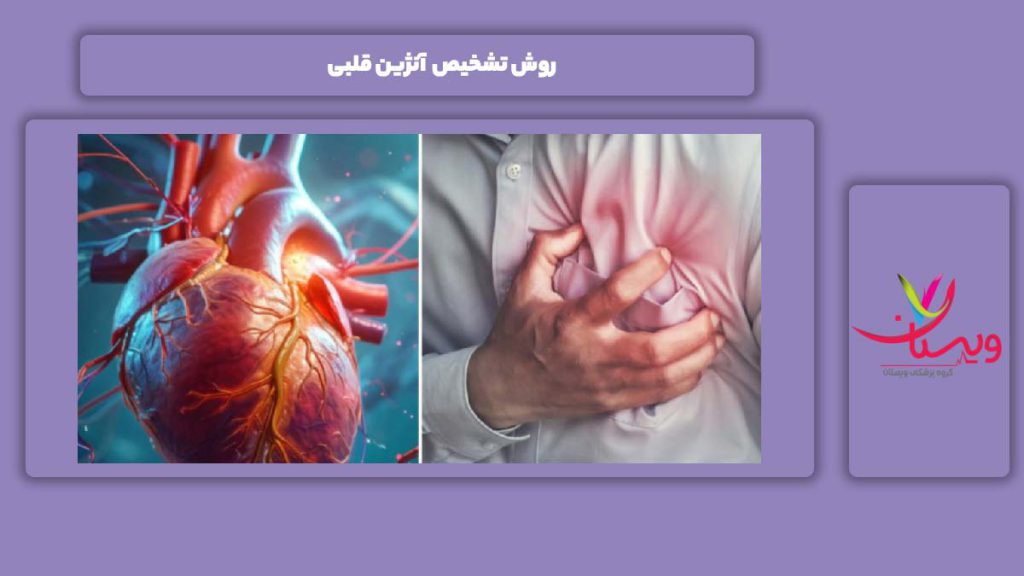 راه شناسایی آنژین قلبی روش تشخیص آنژین قلبی