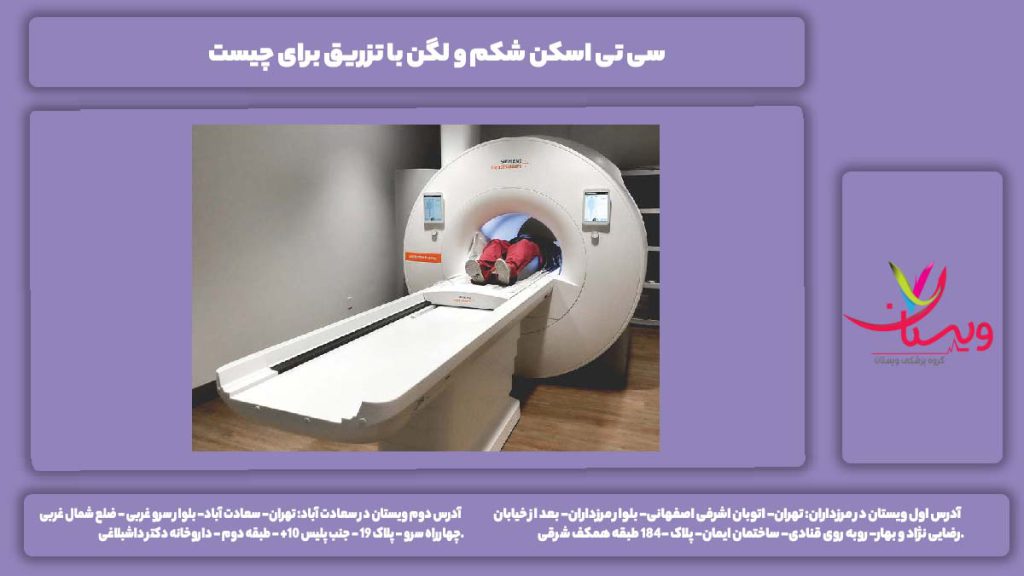 سی تی اسکن شکم و لگن با تزریق برای چیست