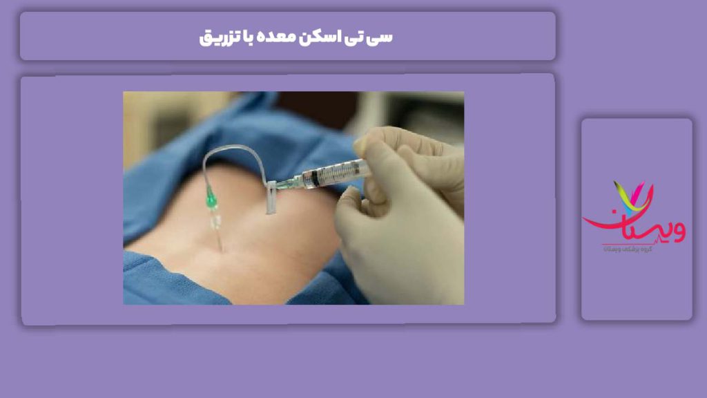 ویژگی سی تی اسکن معده با تزریق سی تی اسکن معده با تزریق