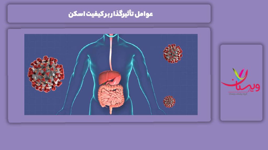 دلیل موثر بر کیفیت اسکن عوامل تأثیرگذار بر کیفیت اسکن