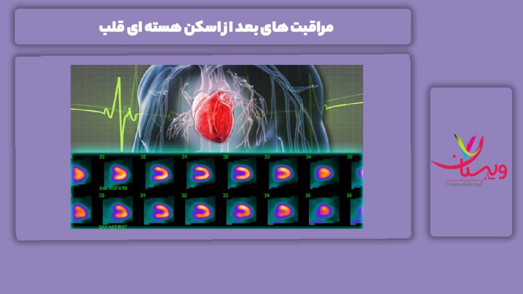 مراقبت بعد از انجام اسکن مراقبت های بعد از اسکن هسته ای قلب