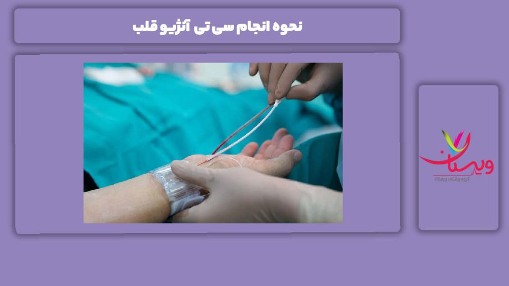 روش انجام سی تی آنژیو برای قلب نحوه انجام سی تی آنژیو قلب