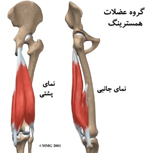 عضلات تاندینوپاتی دارای دو عضلبه تاندونی است یکی بیرونی و یک جانبی است. کشیدگی تاندینوپاتی همسترینگ باعث پارگی فیبر عضله می شود.
