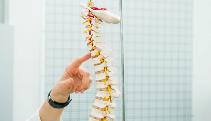 سندروم اسکولیوز در موارد مزمن باید جراحی شود.