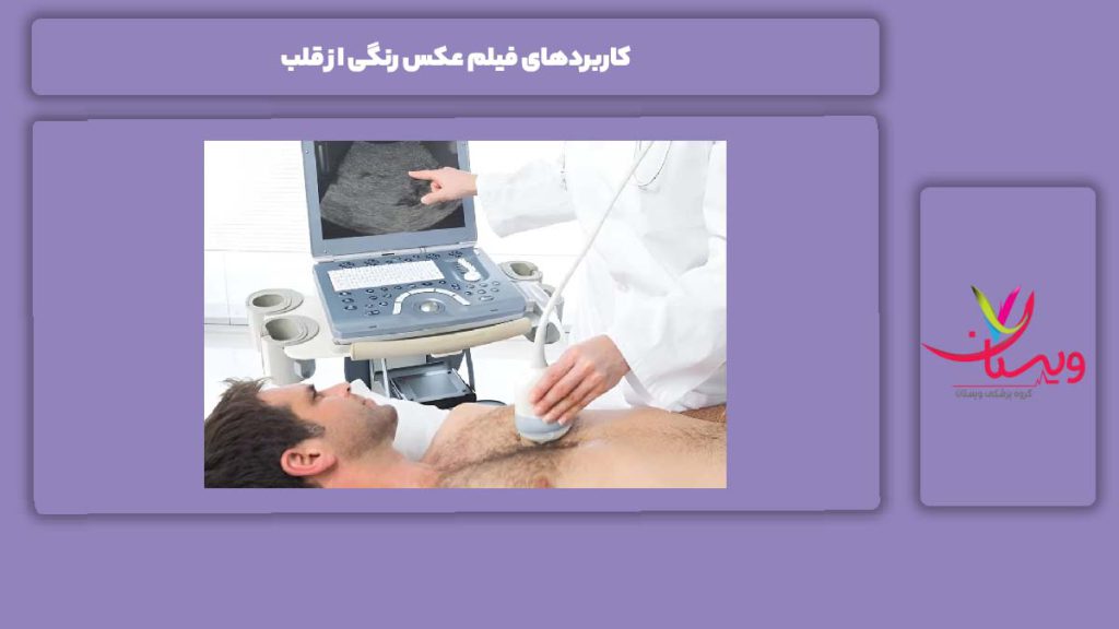 کاربرد اصلی فیلم قلب 6 کاربرد مفید فیلم عکس رنگی از قلب