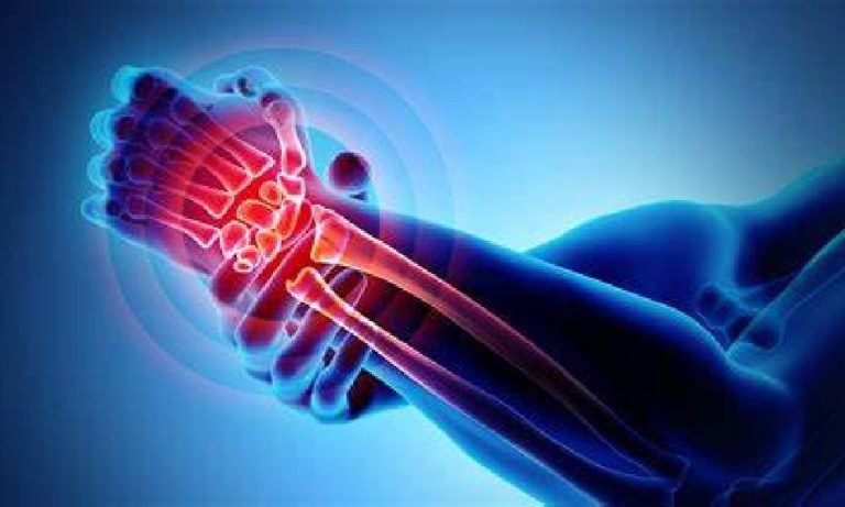 آرتروز انگشت شست یک بیماری مزمن است.